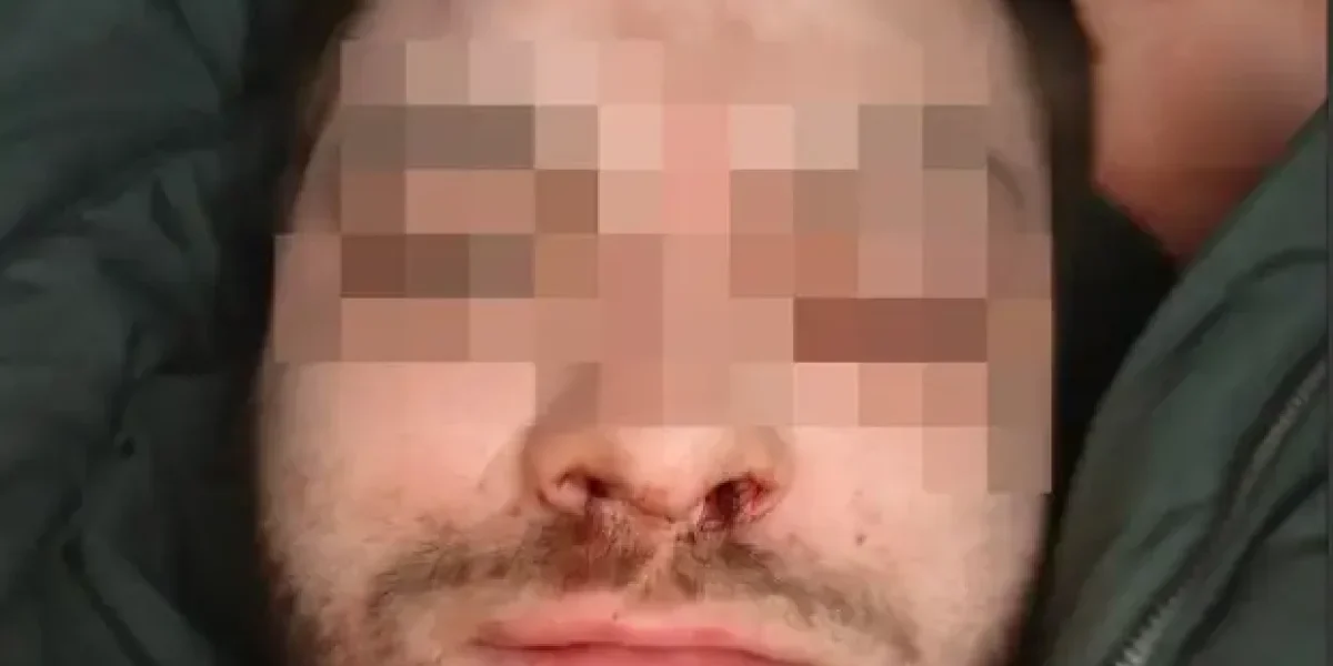 Приезжие избили парня с протезами. Били ногами даже женщины. Полиция просит не раздувать Приезжие избили парня с протезами. Били ногами даже женщины. Полиция просит не раздувать